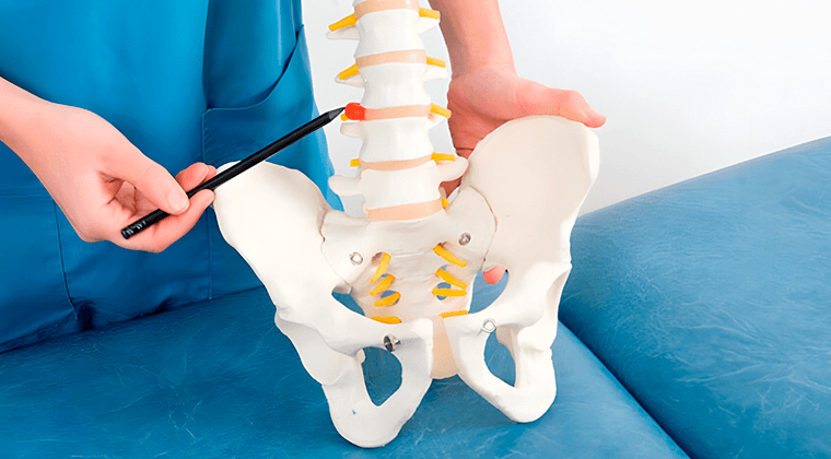 Hernias Discales