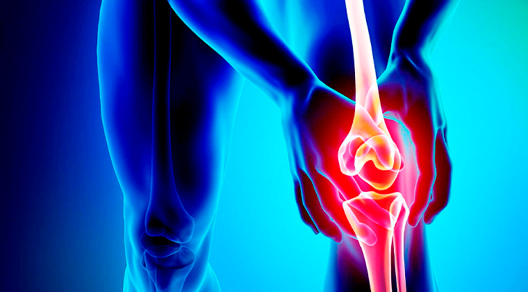 Imagen de Artrosis (Desgaste Articular)